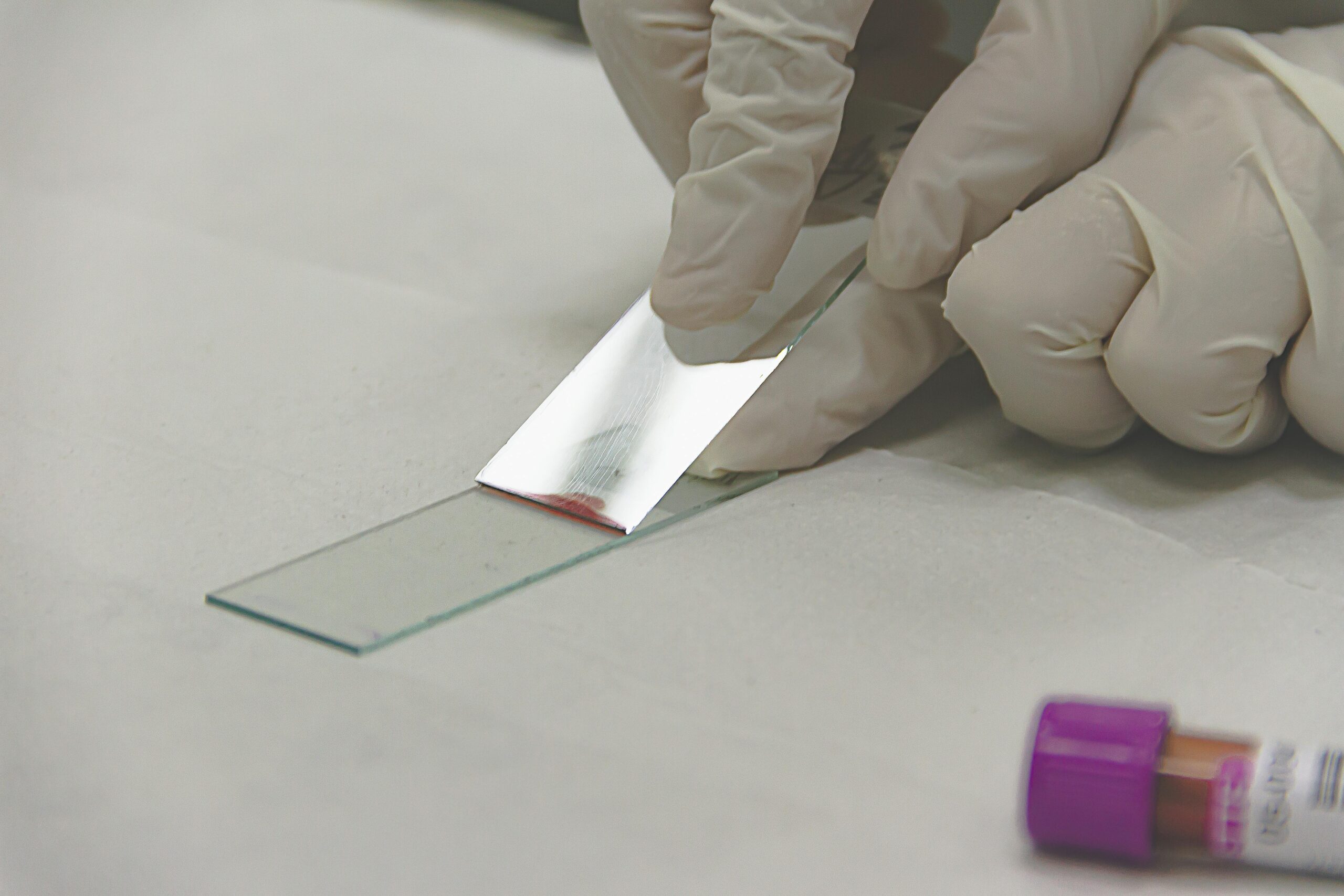 Blood test sample for colon cancer screening, showing a vial of blood being prepared for analysis to detect colorectal cancer biomarkers.